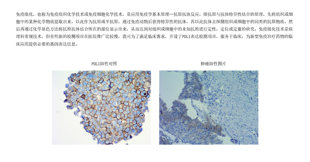 4檢測(cè)項(xiàng)目- IHC平臺(tái).jpg